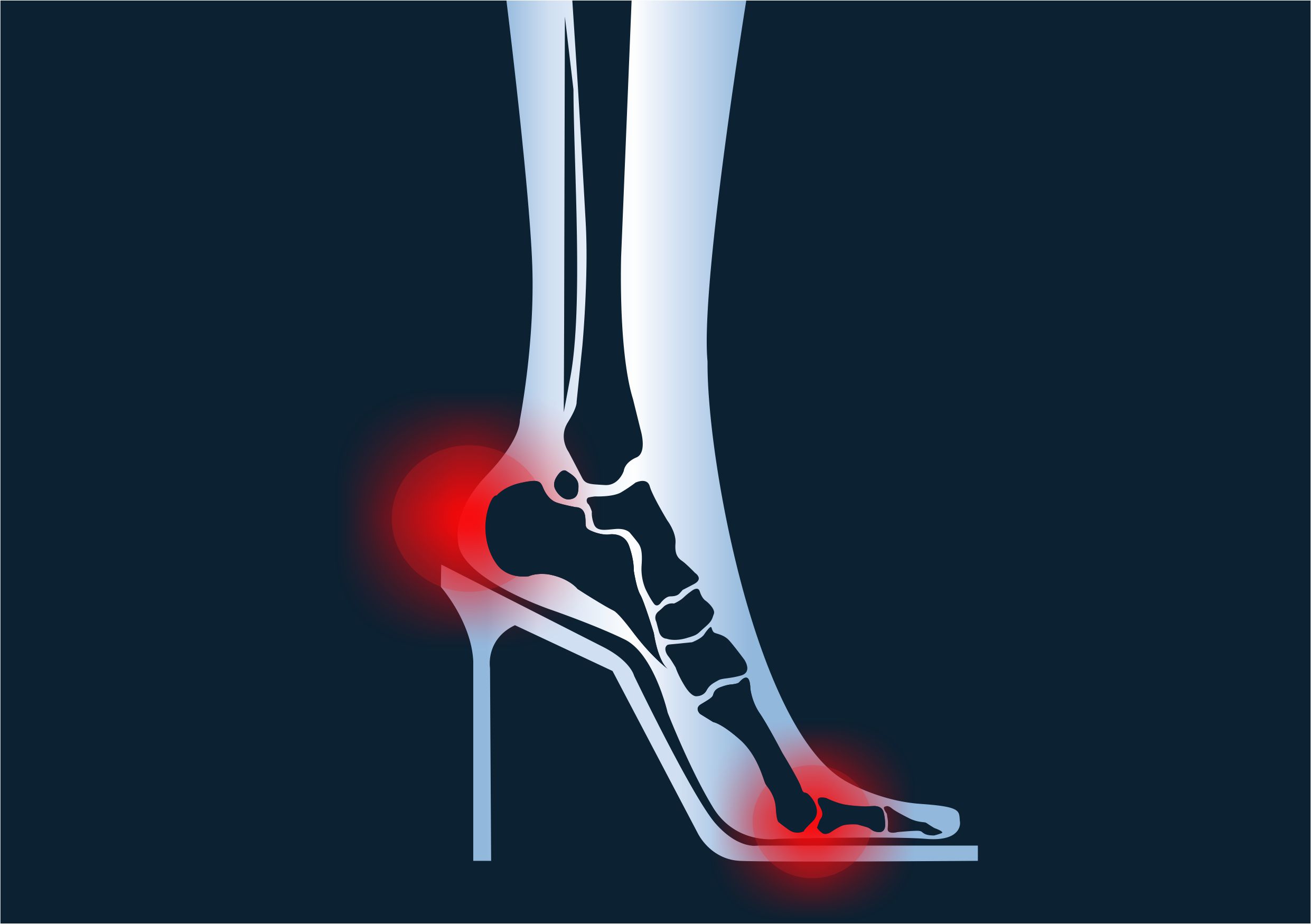 Symptoms pain on foot - saaurabh