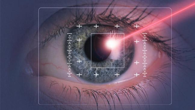 Is Laser Surgery for me?