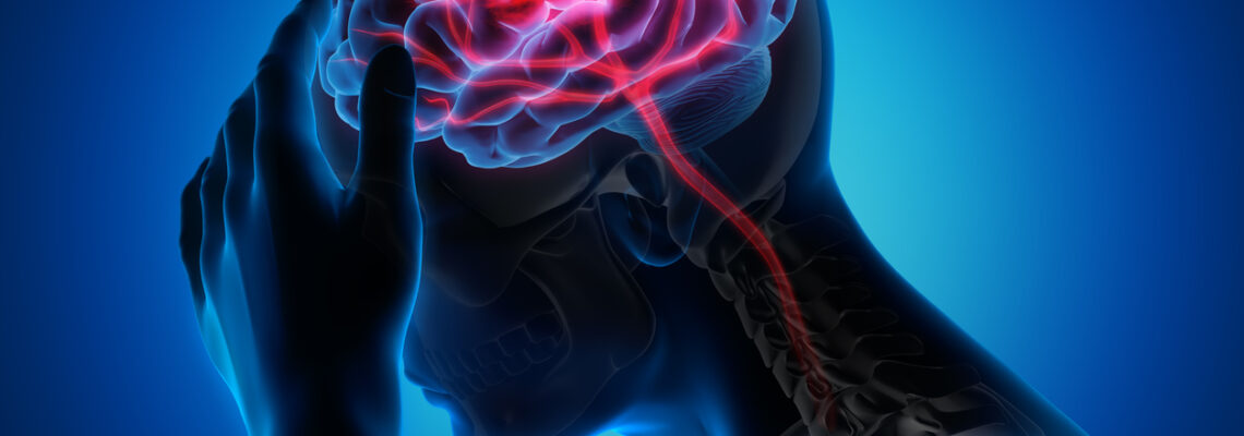About 80% Of Strokes Are Preventable: Here Are 5 Ways To Cut Down Your Risk